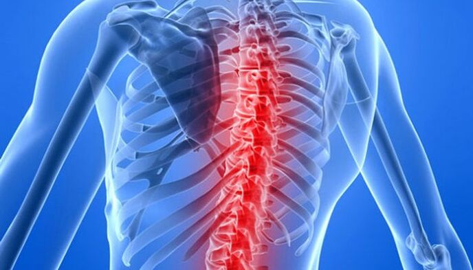 Patologije kičme su najčešći uzroci bolova u leđima u području lopatica