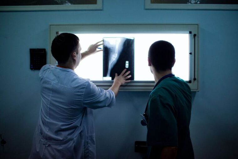 Dijagnoza artroze na x -ray
