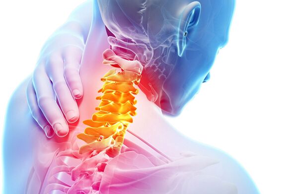 Cervikalna osteohondroza