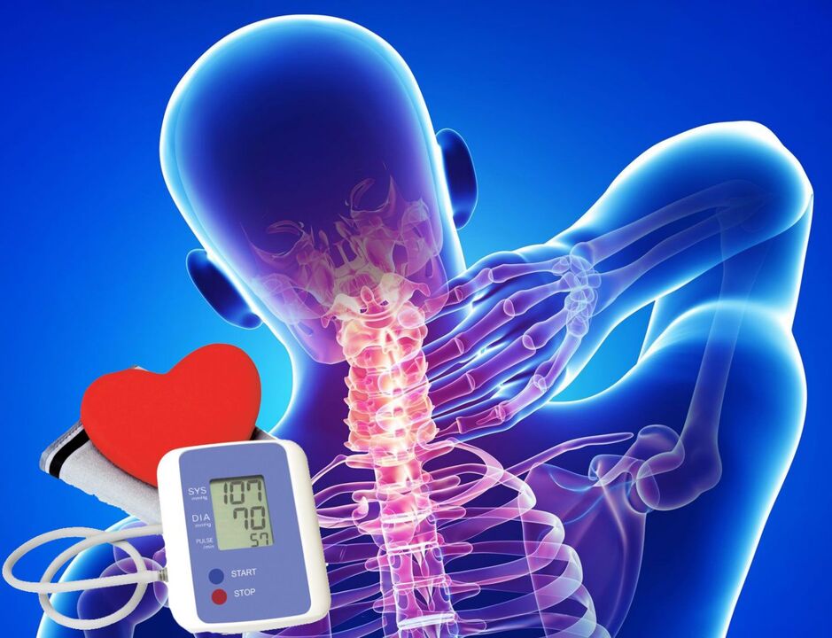 Skokovi krvnog tlaka s cervikalnom osteohondrozo